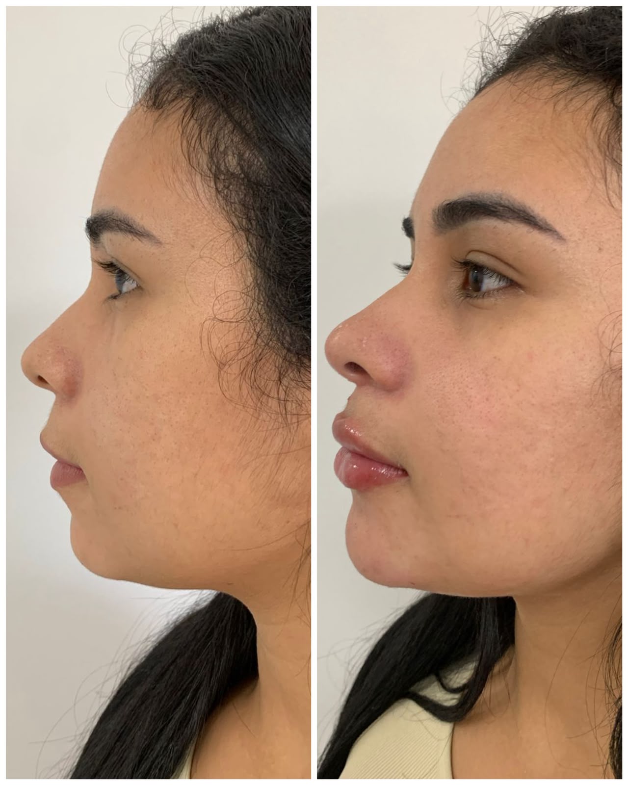 Programa Pós-Emagrecimento — Fabiana Rocha Centro de Estética